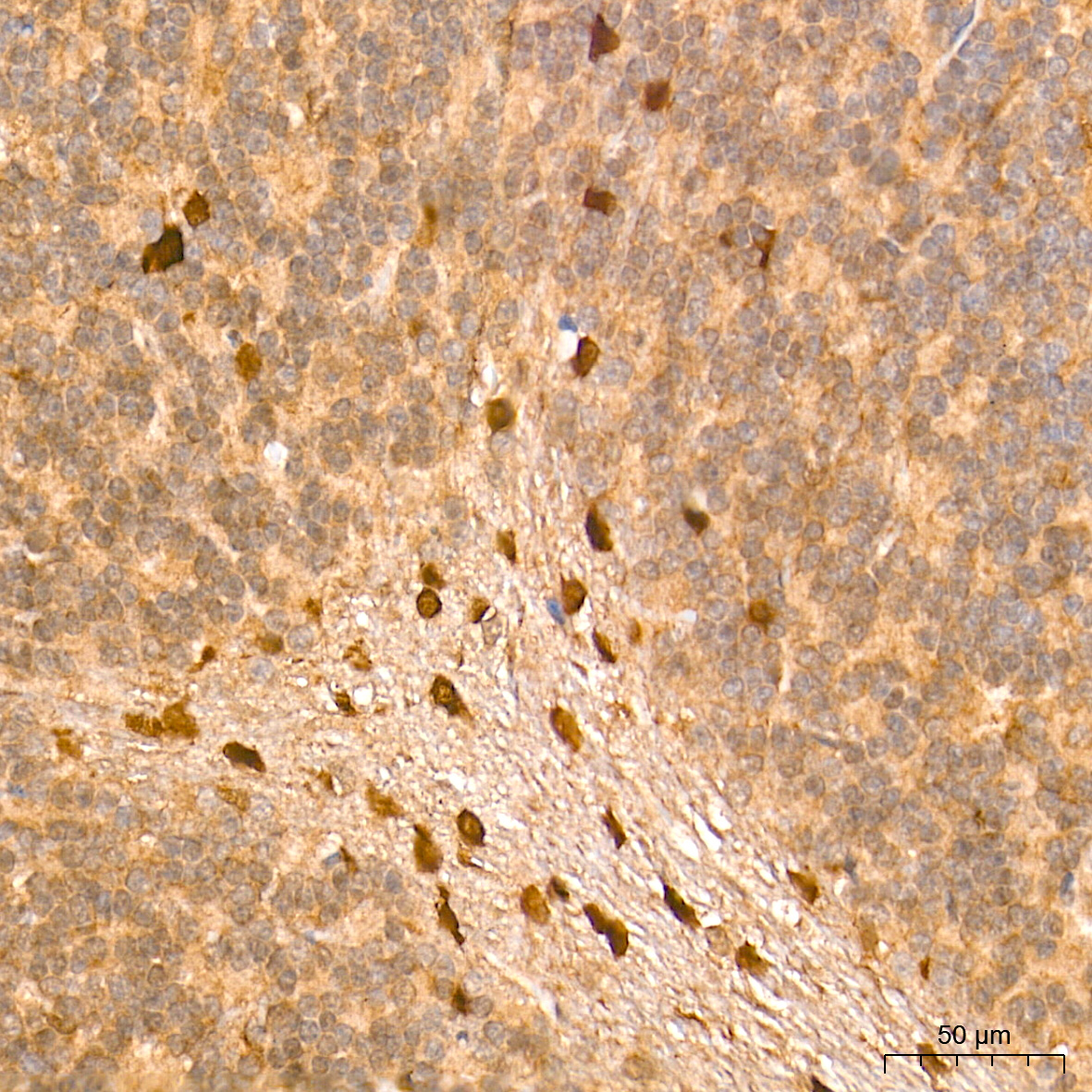 ERK1/2 Rabbit mAb