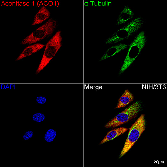 Aconitase 1 (ACO1) Rabbit mAb