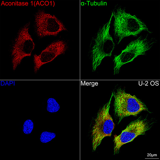 Aconitase 1 (ACO1) Rabbit mAb