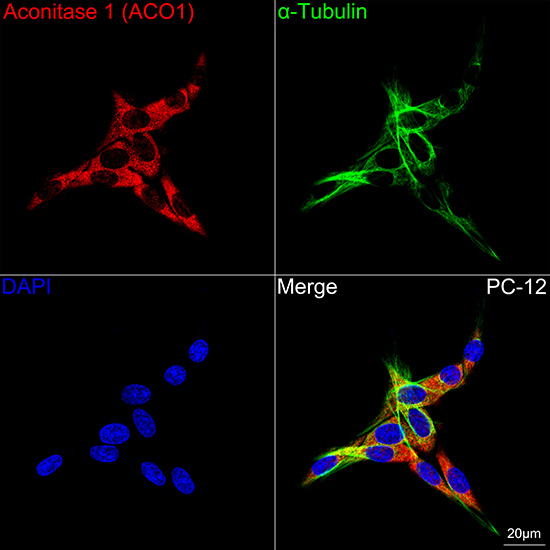Aconitase 1 (ACO1) Rabbit mAb