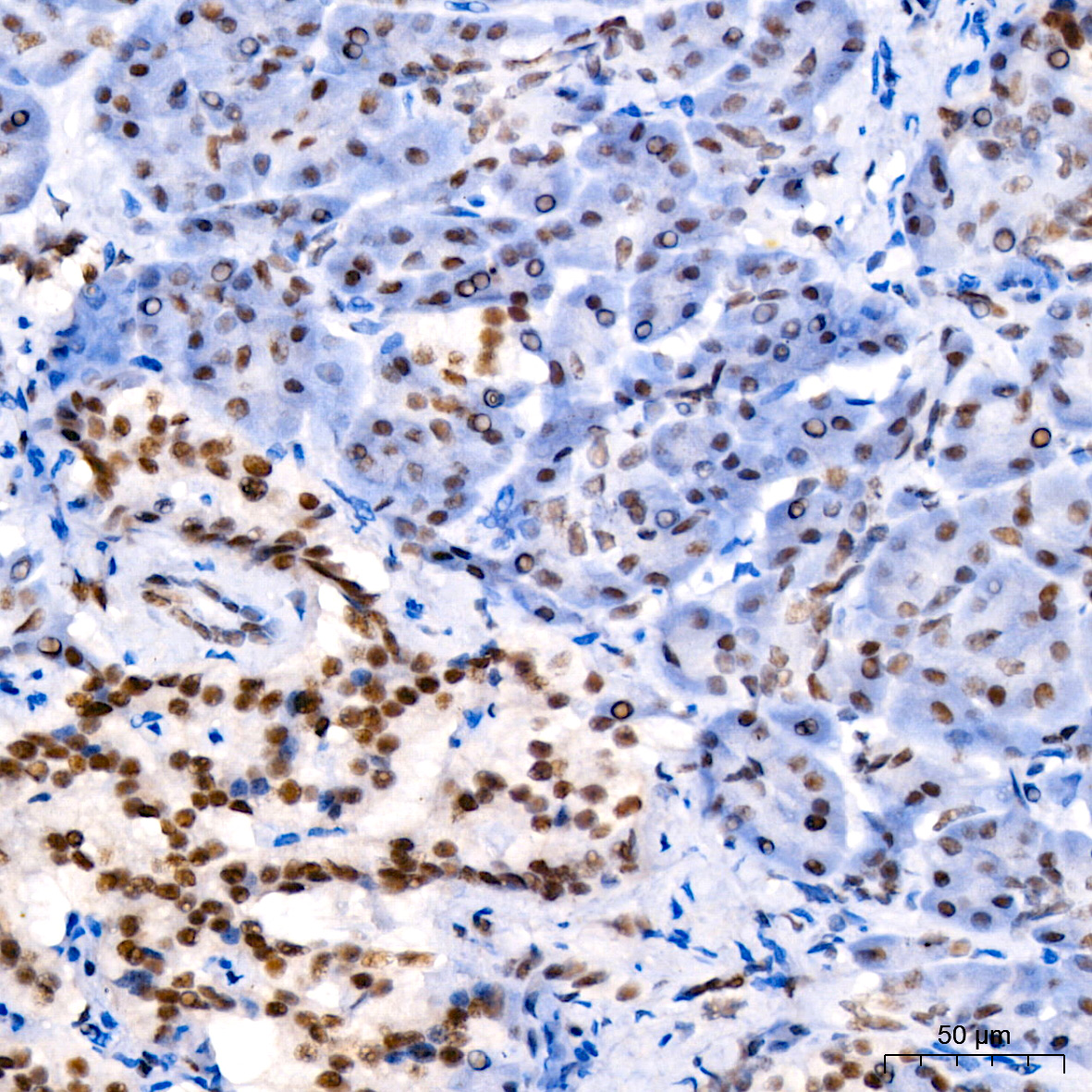 MLH1抗体试剂（免疫组织化学）