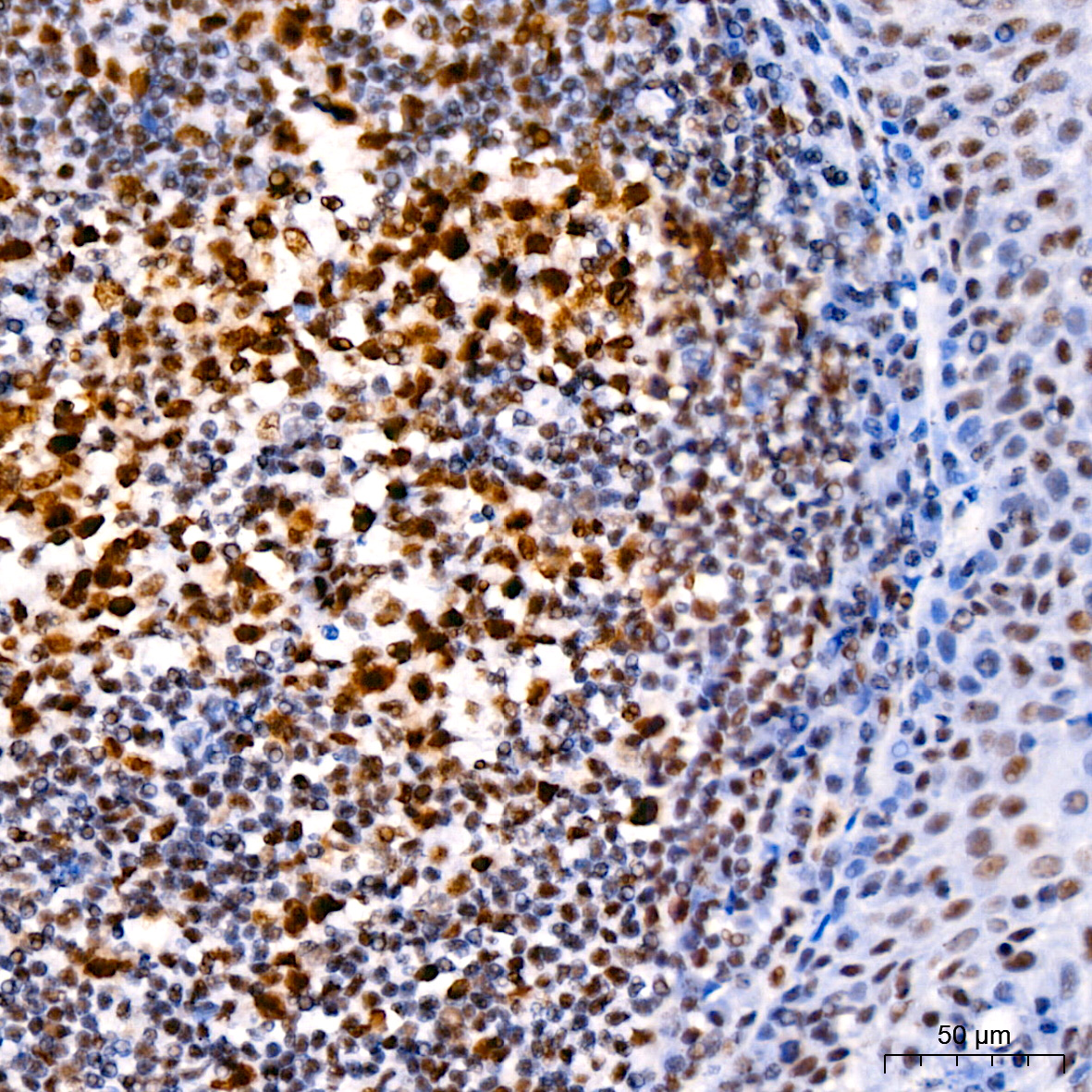 MLH1抗体试剂（免疫组织化学）