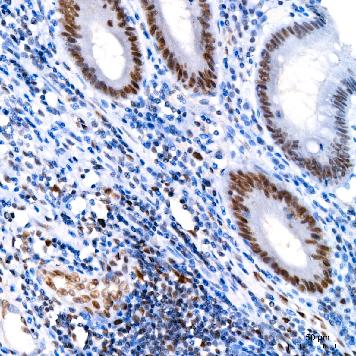 MLH1抗体试剂（免疫组织化学）