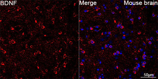 BDNF Rabbit mAb
