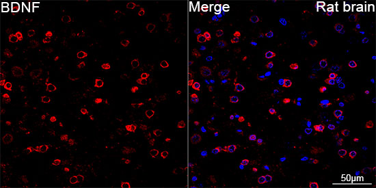 BDNF Rabbit mAb