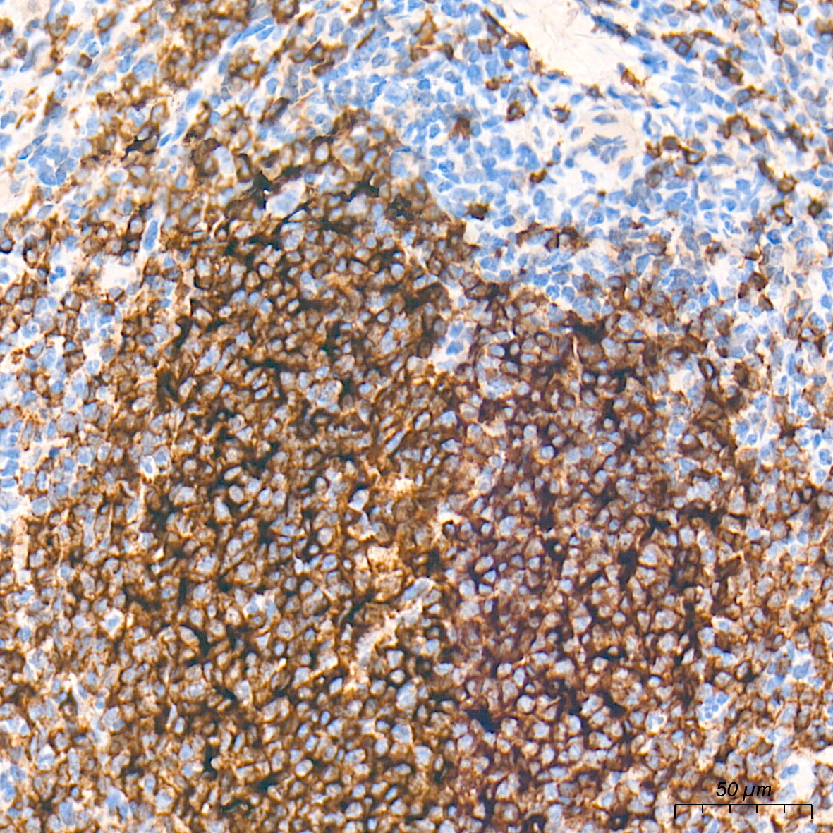CD20 Rabbit mAb