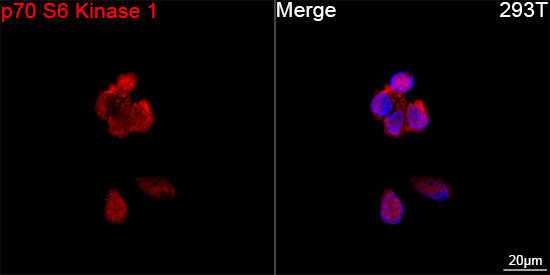 p70 S6 Kinase 1 Rabbit mAb