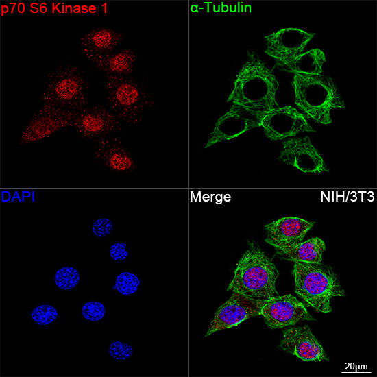 p70 S6 Kinase 1 Rabbit mAb