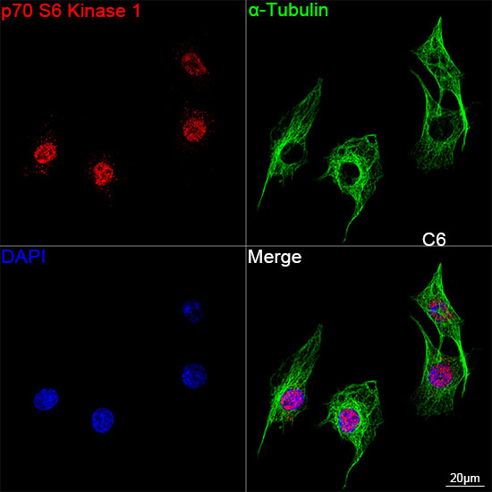 p70 S6 Kinase 1 Rabbit mAb