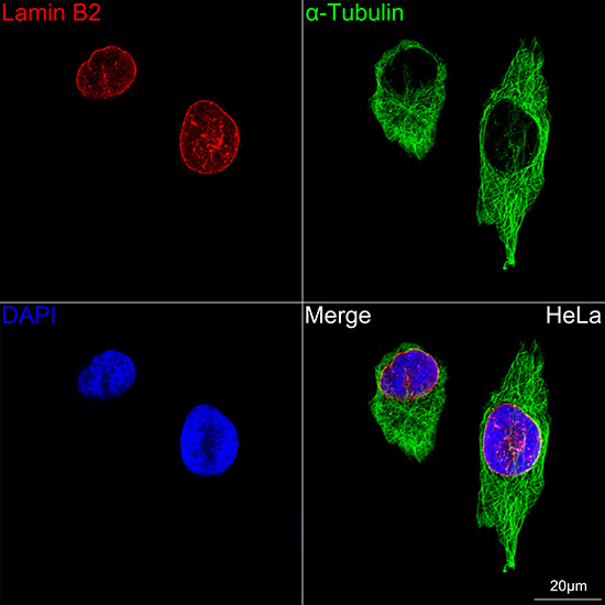 Lamin B2 Rabbit mAb