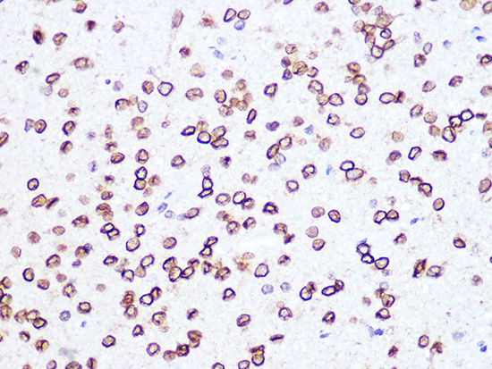 Lamin B2 Rabbit mAb