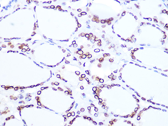 Lamin B2 Rabbit mAb