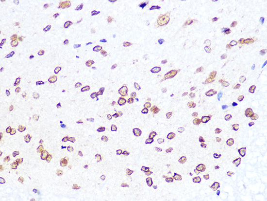 Lamin B2 Rabbit mAb