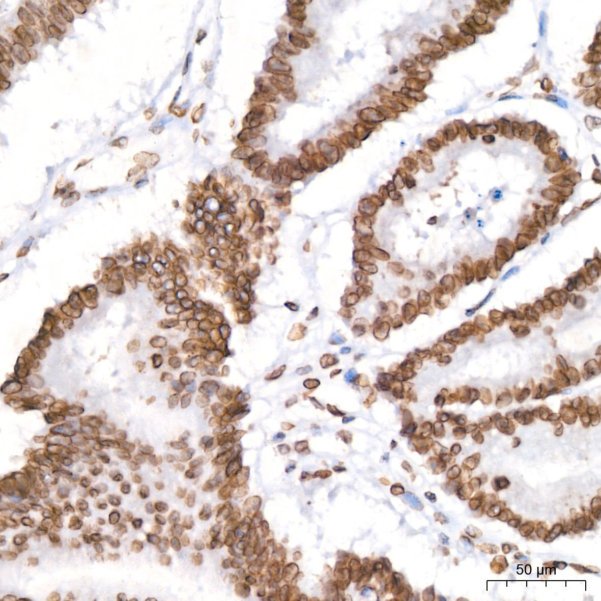 Lamin B2 Rabbit mAb