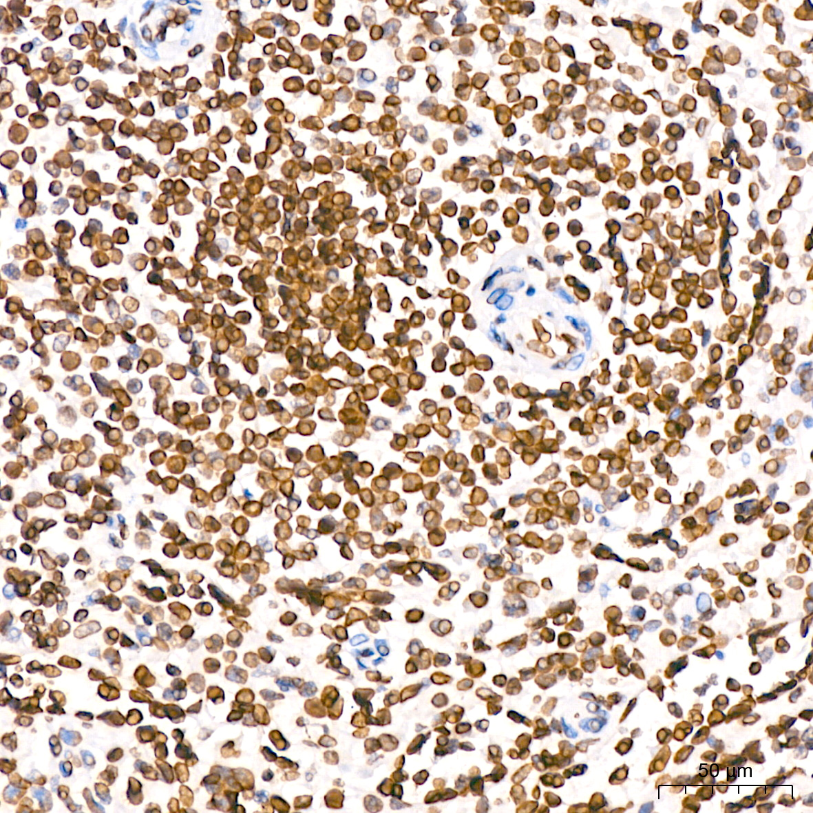 Lamin B2 Rabbit mAb