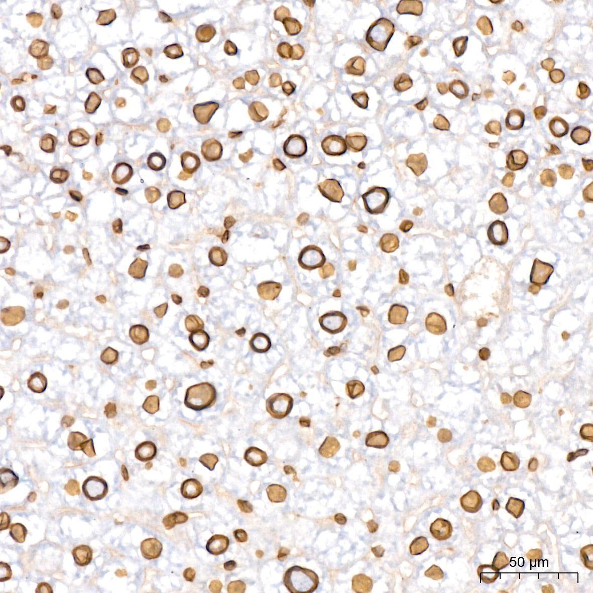Lamin B2 Rabbit mAb