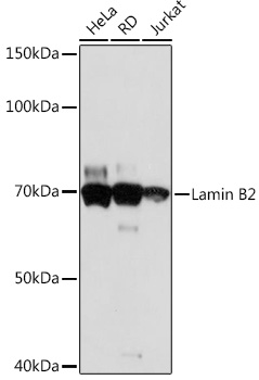Lamin B2 Rabbit mAb