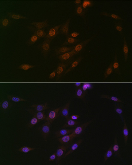 p38 MAPK Rabbit mAb
