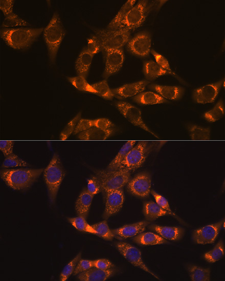 DLDH/DLD Rabbit mAb
