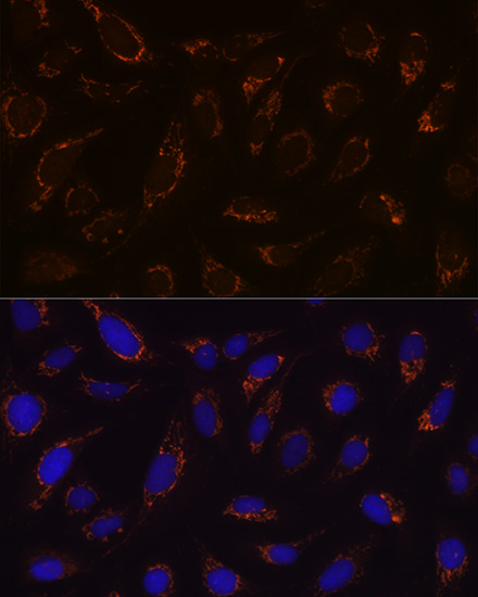 DLDH/DLD Rabbit mAb