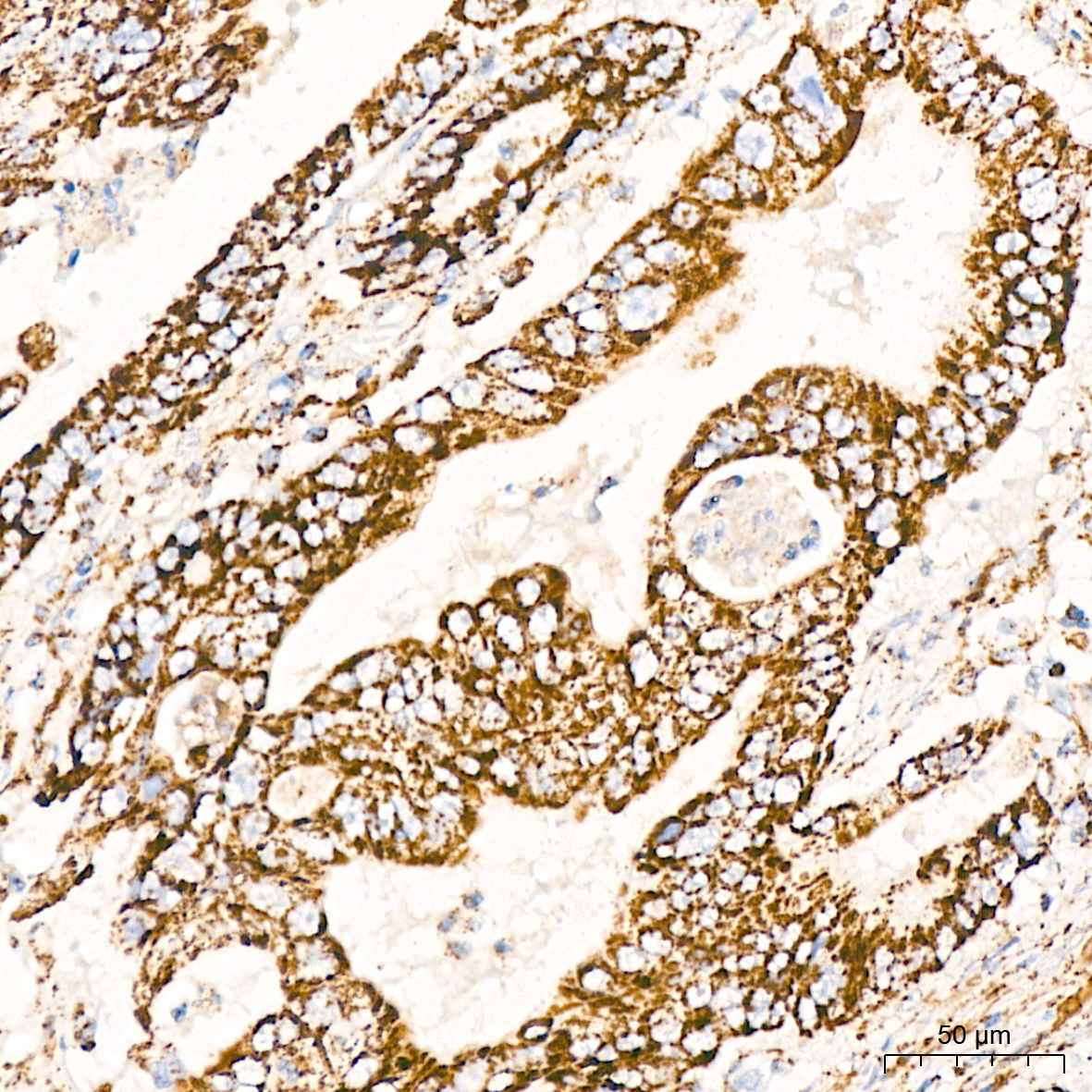 DLDH/DLD Rabbit mAb