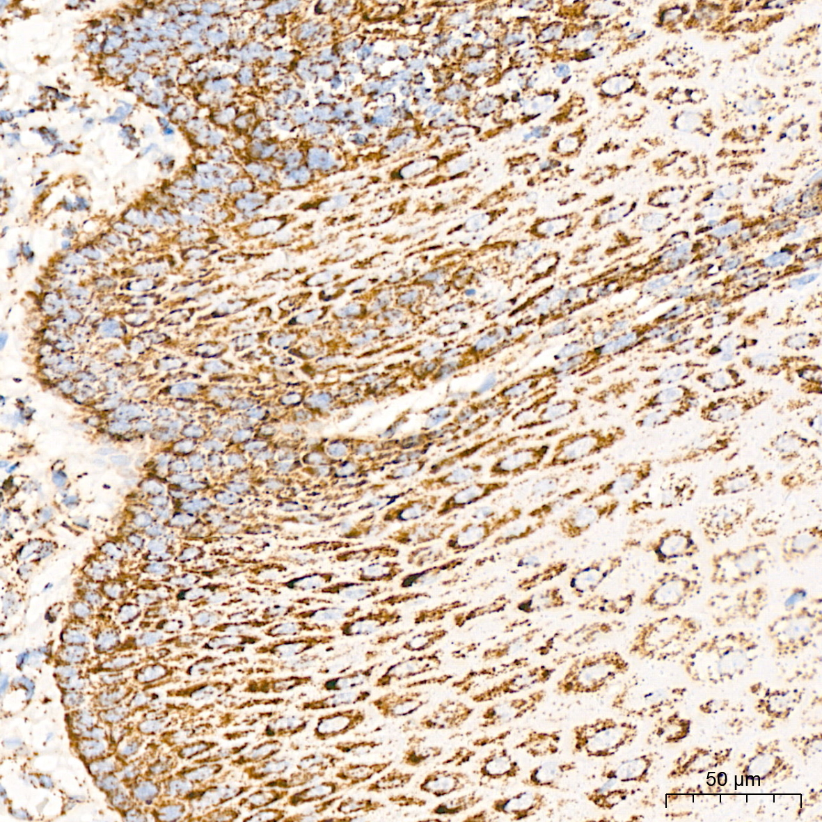 DLDH/DLD Rabbit mAb