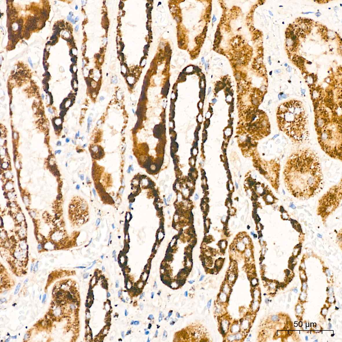 DLDH/DLD Rabbit mAb