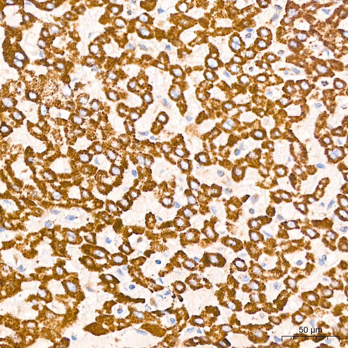 DLDH/DLD Rabbit mAb
