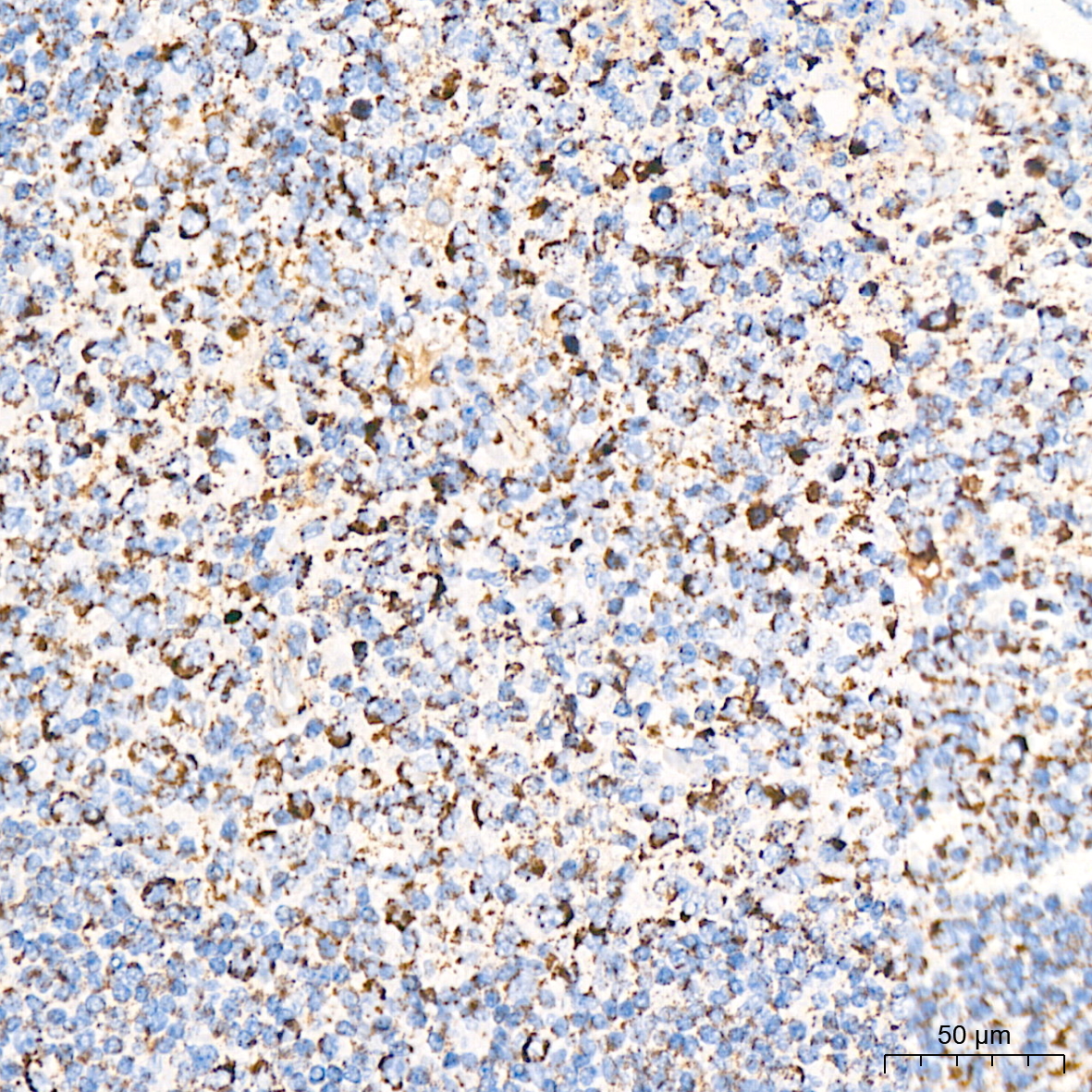 DLDH/DLD Rabbit mAb
