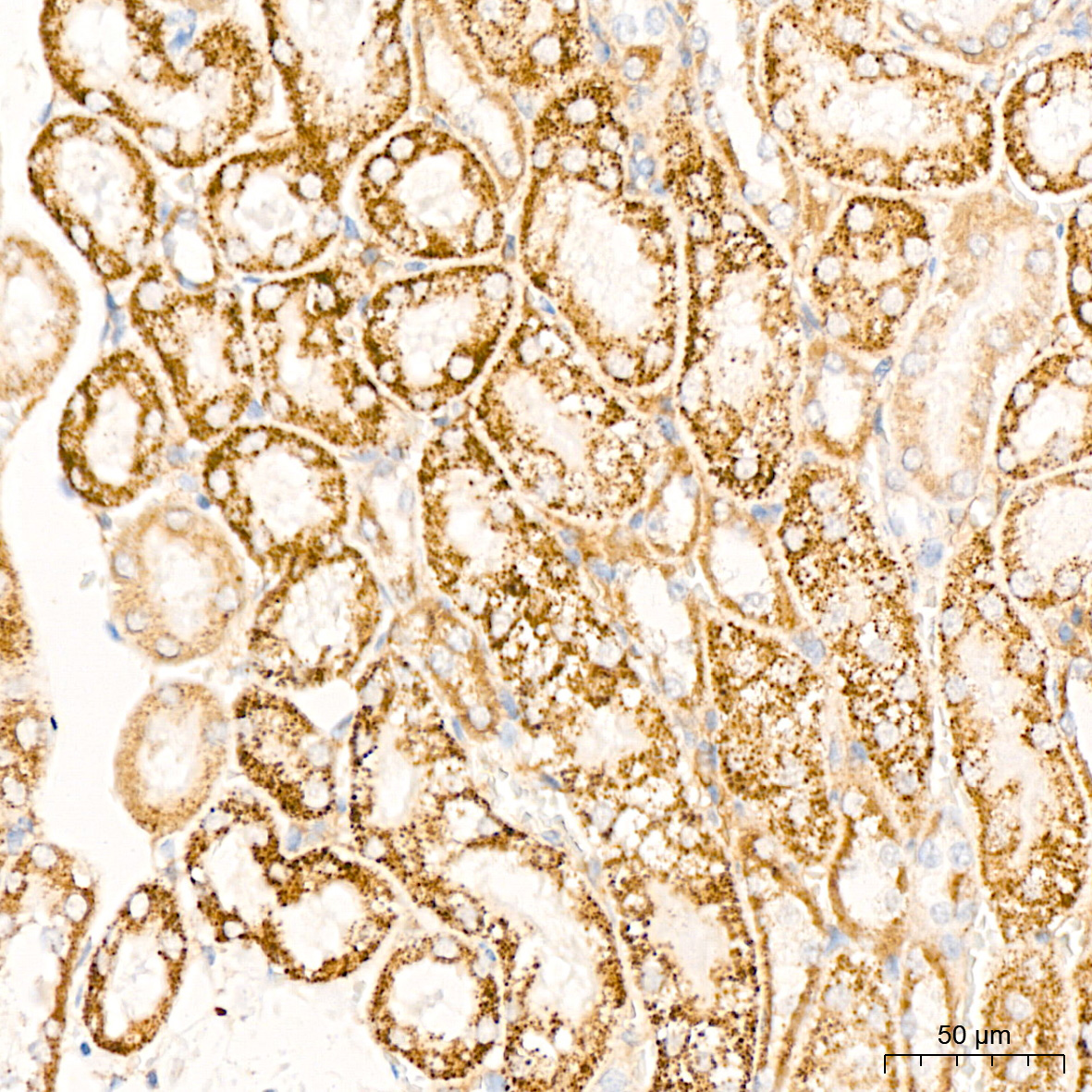 DLDH/DLD Rabbit mAb