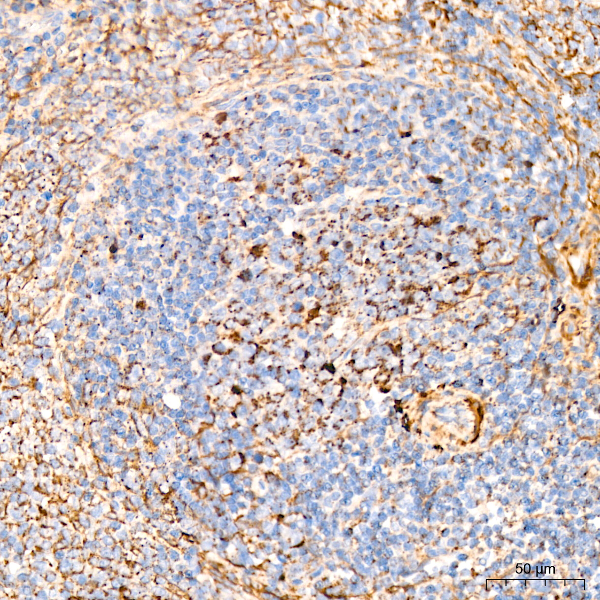 DLDH/DLD Rabbit mAb