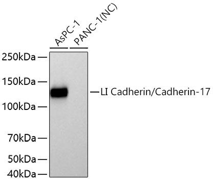 LI Cadherin/Cadherin-17 Rabbit mAb
