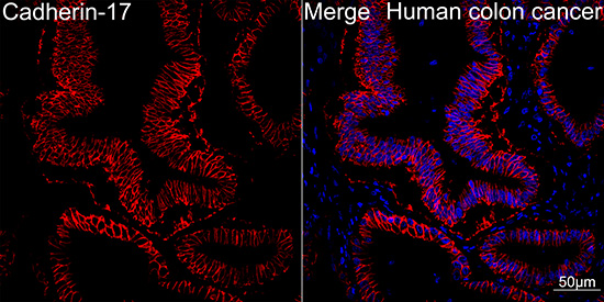 LI Cadherin/Cadherin-17 Rabbit mAb