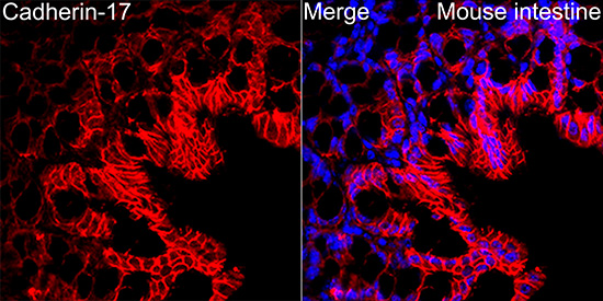 LI Cadherin/Cadherin-17 Rabbit mAb