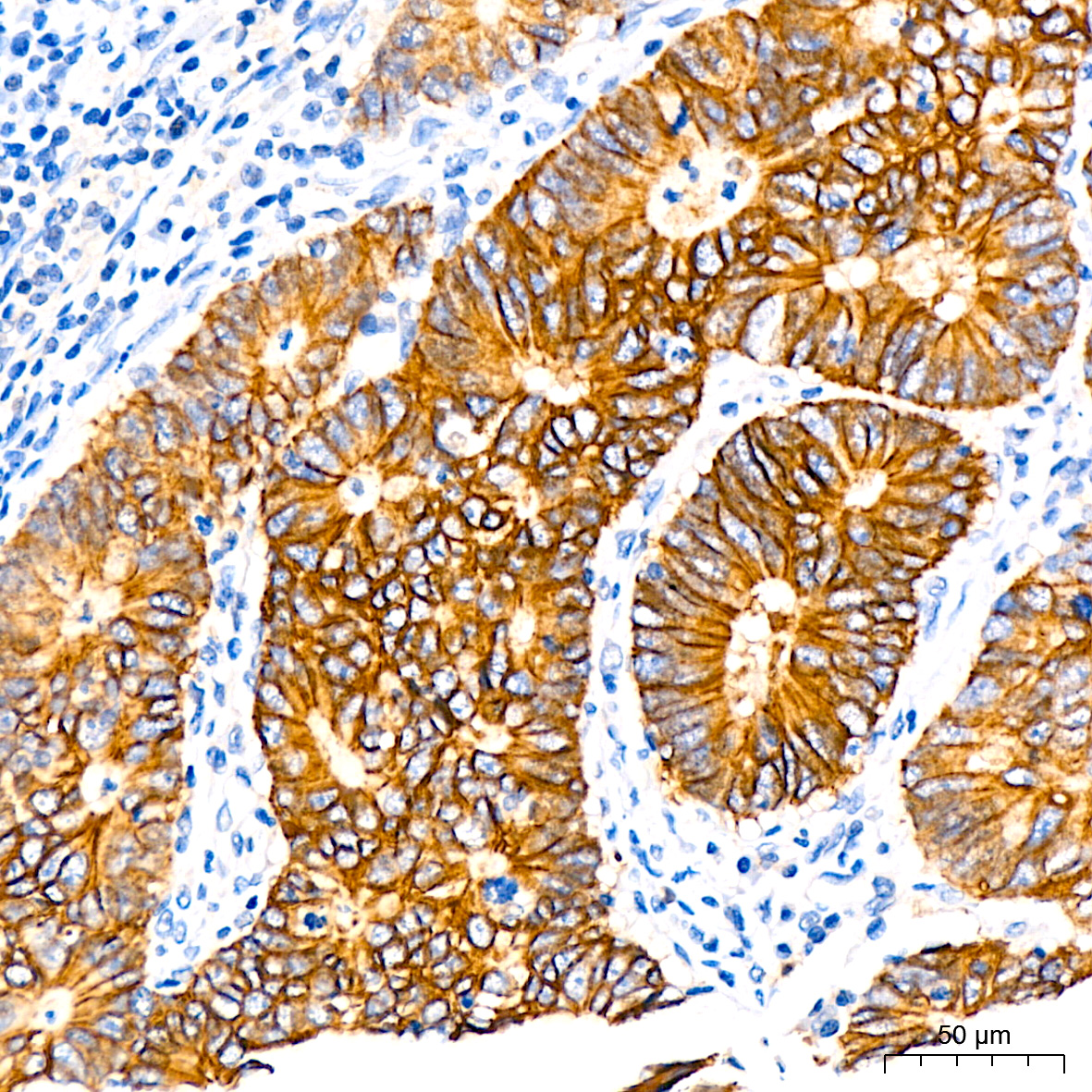 LI Cadherin/Cadherin-17 Rabbit mAb
