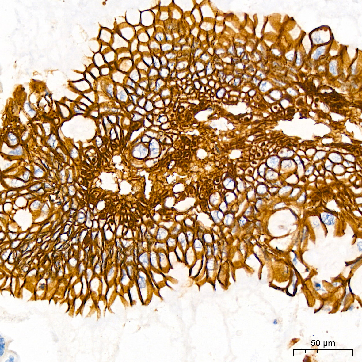 LI Cadherin/Cadherin-17 Rabbit mAb