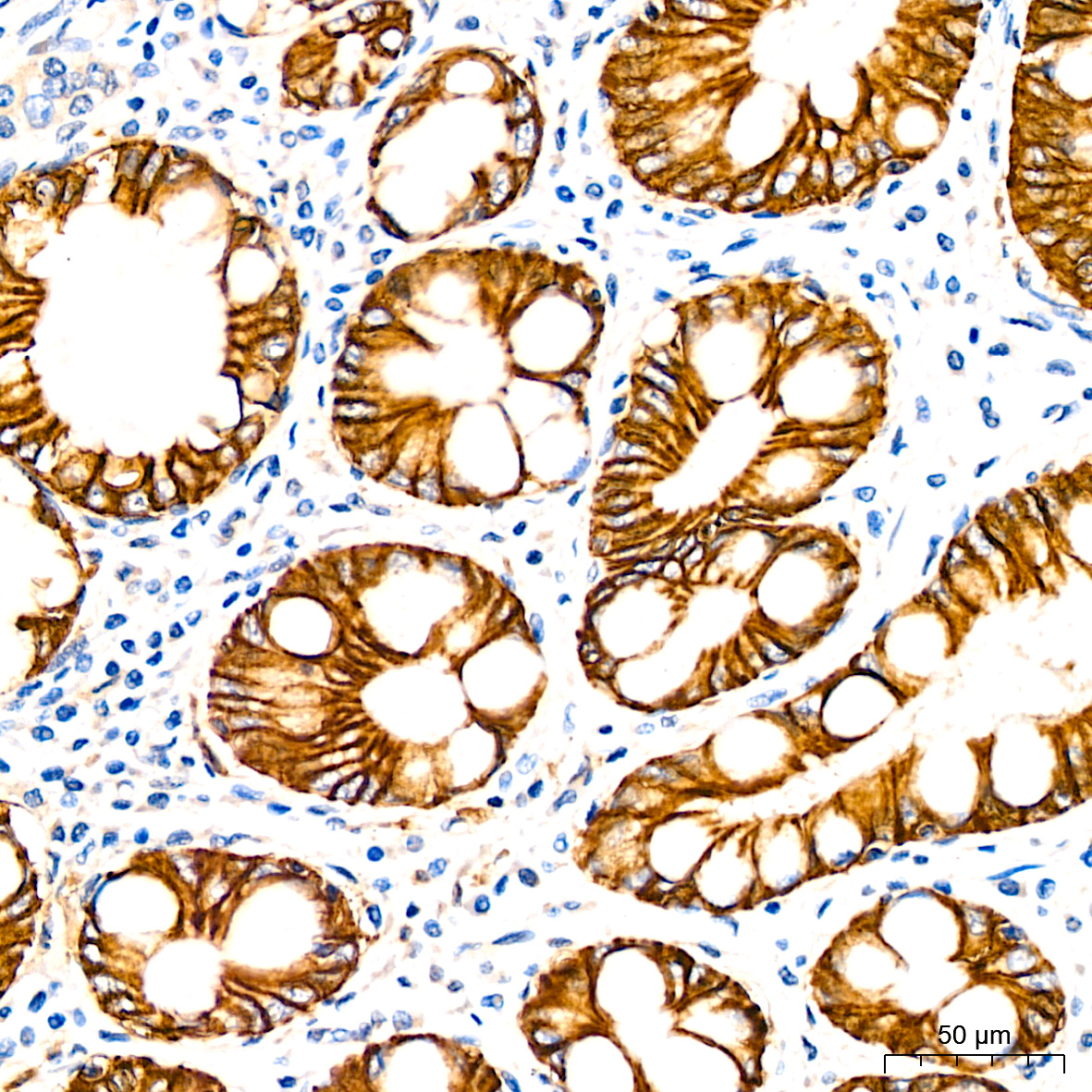 LI Cadherin/Cadherin-17 Rabbit mAb