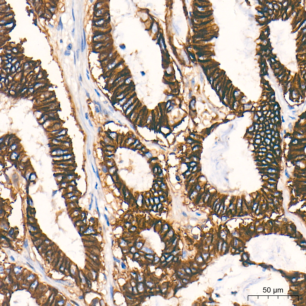 LI Cadherin/Cadherin-17 Rabbit mAb