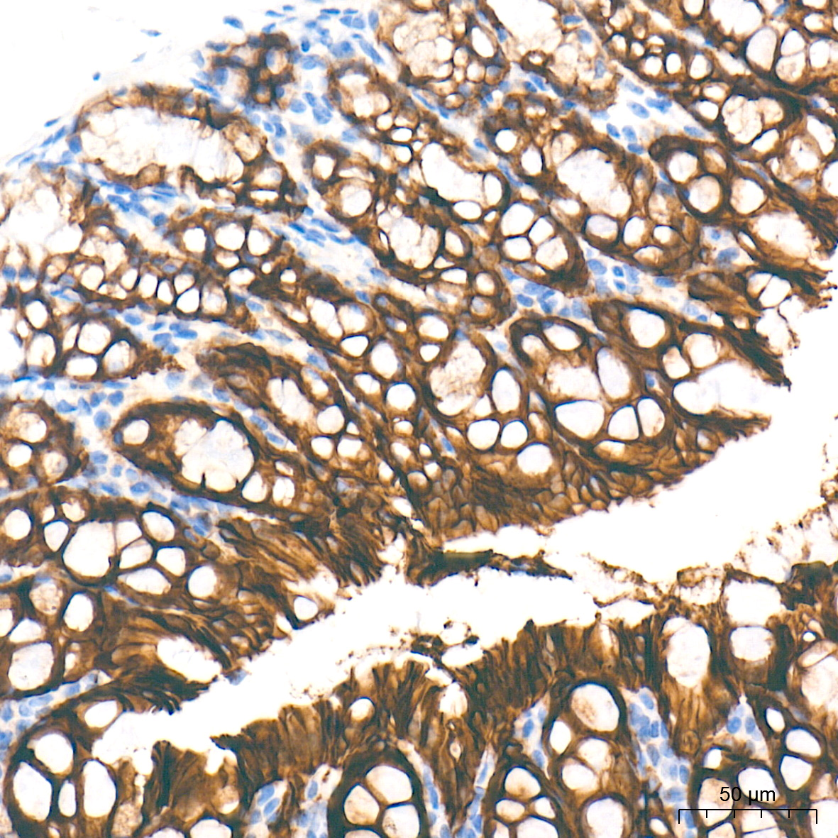 LI Cadherin/Cadherin-17 Rabbit mAb