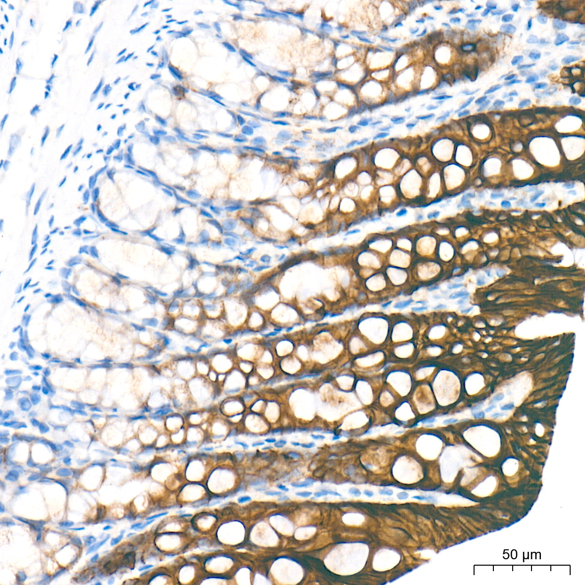 LI Cadherin/Cadherin-17 Rabbit mAb