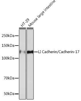 LI Cadherin/Cadherin-17 Rabbit mAb
