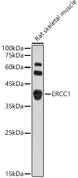 ERCC1 Rabbit pAb