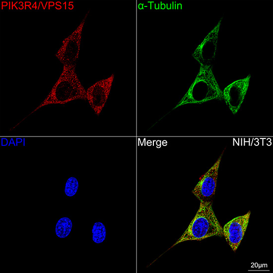 PIK3R4/VPS15 Rabbit mAb