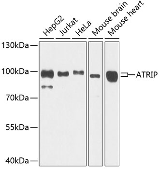 ATRIP Rabbit pAb