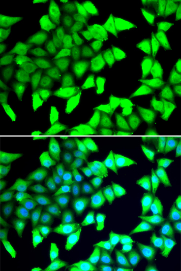 HDAC5 Rabbit pAb