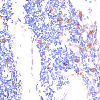 WNT5B Rabbit pAb