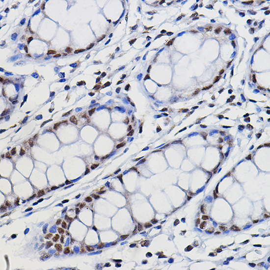 METTL14 Rabbit pAb