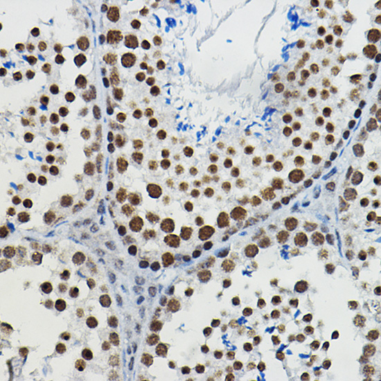 METTL14 Rabbit pAb