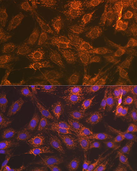 Smac/Diablo Rabbit mAb