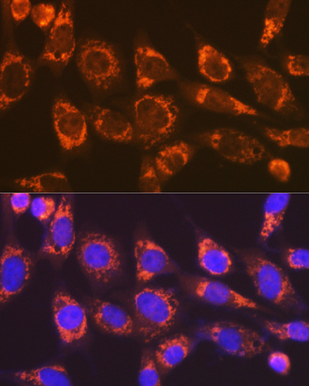 Smac/Diablo Rabbit mAb